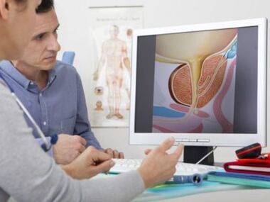 Un urologue conseille un patient sur les problèmes de puissance